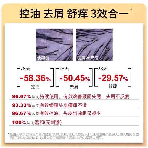 John Jeff1%二硫化硒洗发水卓效去屑控油蓬松舒缓瘙痒3效合一姐夫 - 图1