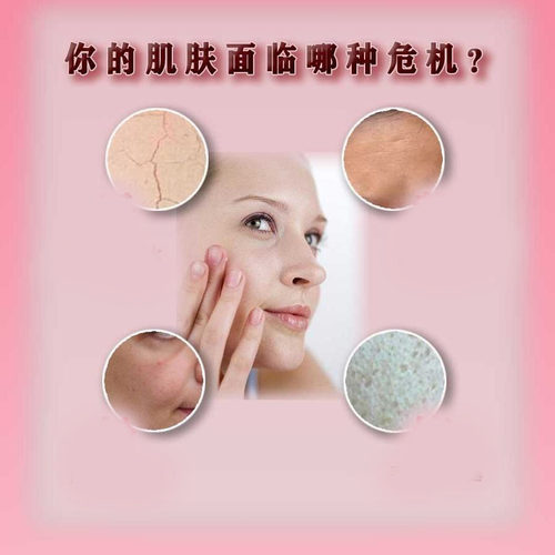 玫瑰香薰软膜粉焕颜靓肤补水保湿面膜粉润肤美容院巴黎魅奈儿 - 图0