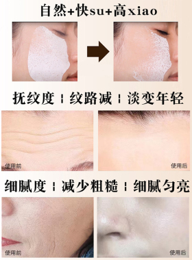 重组胶原蛋白速溶膜淡化法令纹