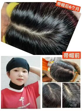 正品活力无限聚能头疗帽生发促睡眠生物电磁疗白发转黑改善脑循环