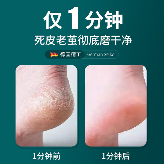 German foot grinder to remove dead skin and pedicure artifact tool