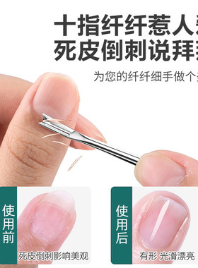 【美甲推荐】死皮叉热销第一名