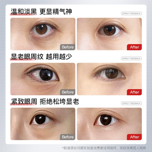 Золотой крем для глаз, осветляющая подтягивающая антивозрастная эссенция, против морщин