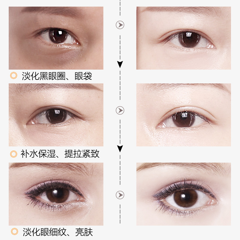 玛茜眼部护肤品套淡化黑眼圈眼袋 玛茜眼部护理套装