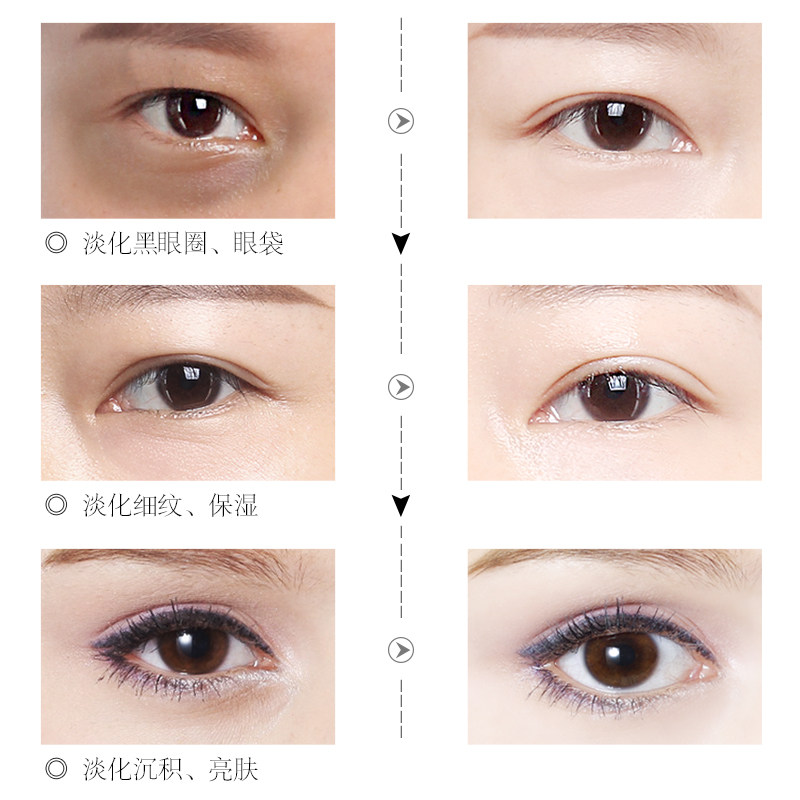 玛茜蜗牛多效美淡化黑眼圈补水眼霜 玛茜眼霜