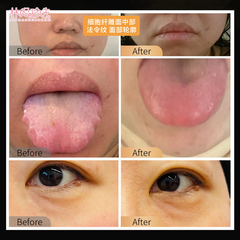 加拿大Etoile玲珑丸 纤雕代谢晶丸AuraVita Plus极光晶丸120粒 - 图2