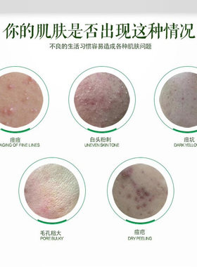 军博仕控痘痘印套装军博士正品