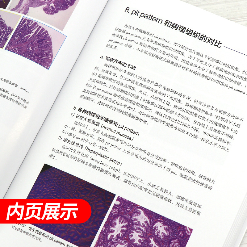 正版 大肠pit pattern诊断图谱 (日)工藤进英 主编 辽宁科学技术出版社 消化内镜操作手册实用消化病学图谱消化内科学消化内科书籍 - 图1