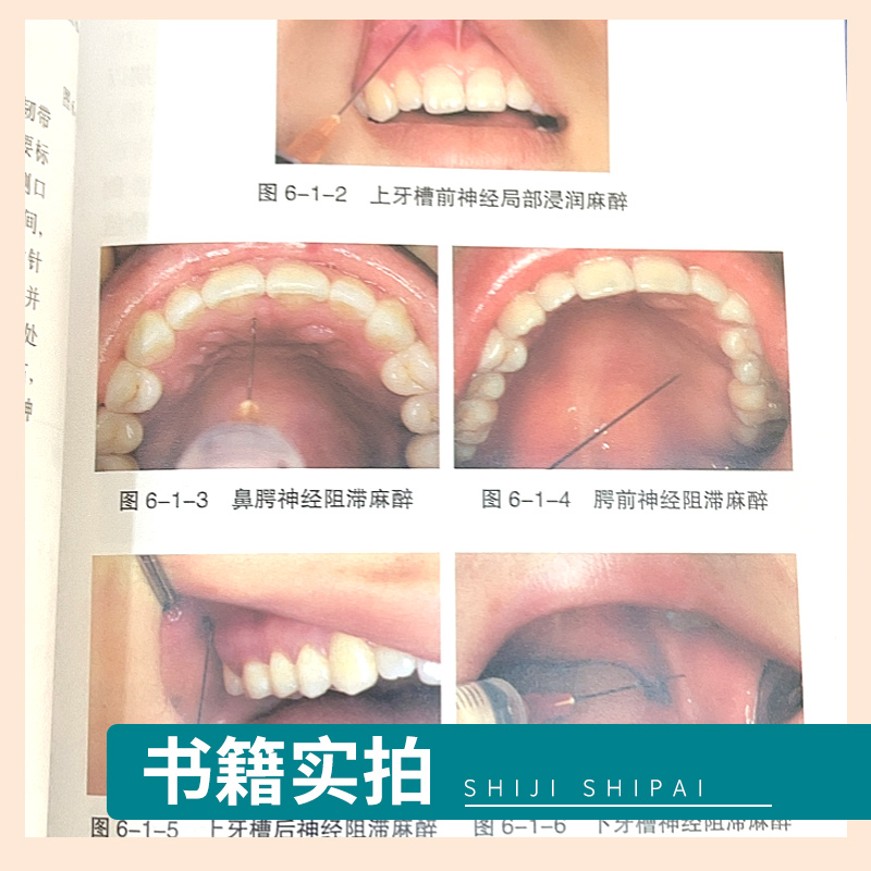 口腔全科医师临床操作手册 陈永进 口腔医生诊所牙科治疗指导参考用书口腔科学书籍 口腔临床医学书籍人民卫生出版社9787117161527 - 图1