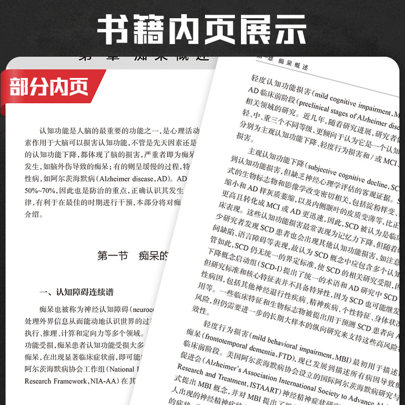 2021 新版中国老年期痴呆防治指南 于恩彦 防治老年痴呆的诊治病人康复痴呆的预防和干预痴呆认知阿尔兹海默症 人民卫生出版社 - 图2