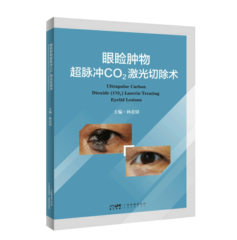 眼睑肿物超脉冲CO2激光切除术 林羡钗 广东技术出版社 50例病例介绍 高清眼睑颜面外观图片 超脉冲CO2激光临床应用 外科学 - 图0