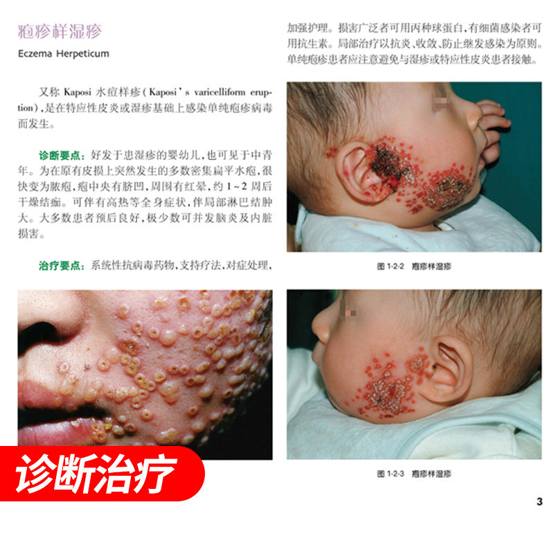 中国皮肤病性病图鉴朱学骏皮肤学 盛世天佑图书皮肤病学/性病学