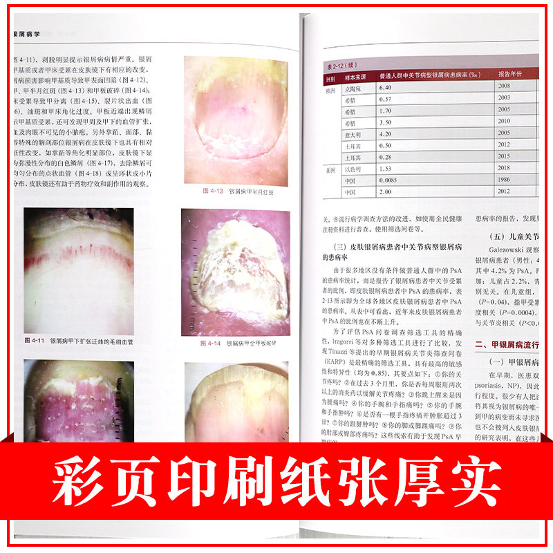 正版银屑病学秦万章顾军主编手册 盛世天佑图书皮肤病学/性病学