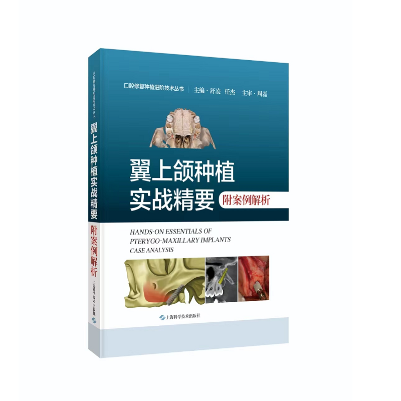 翼上颌种植实战精要 附案例解析 舒凌 任杰 主编 上海科学技术出版社 适合口腔种植科医师阅读 上颌磨牙区垂直骨高度不足