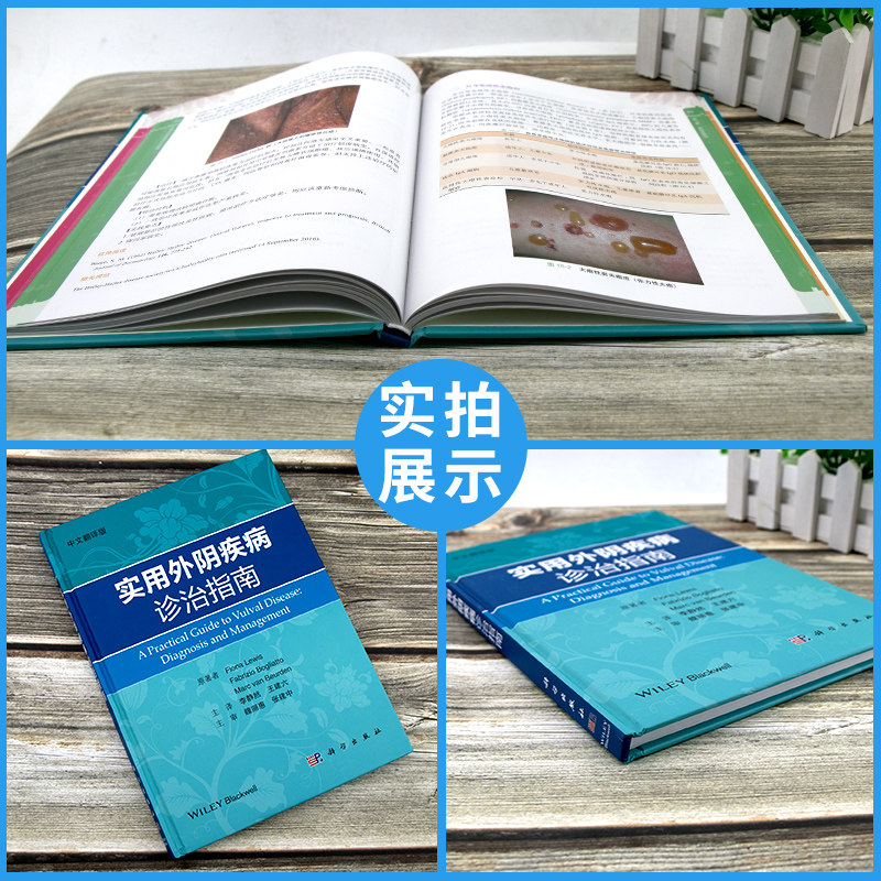 实用外阴诊治指南中文翻译版解剖书 盛世天佑图书妇产科学