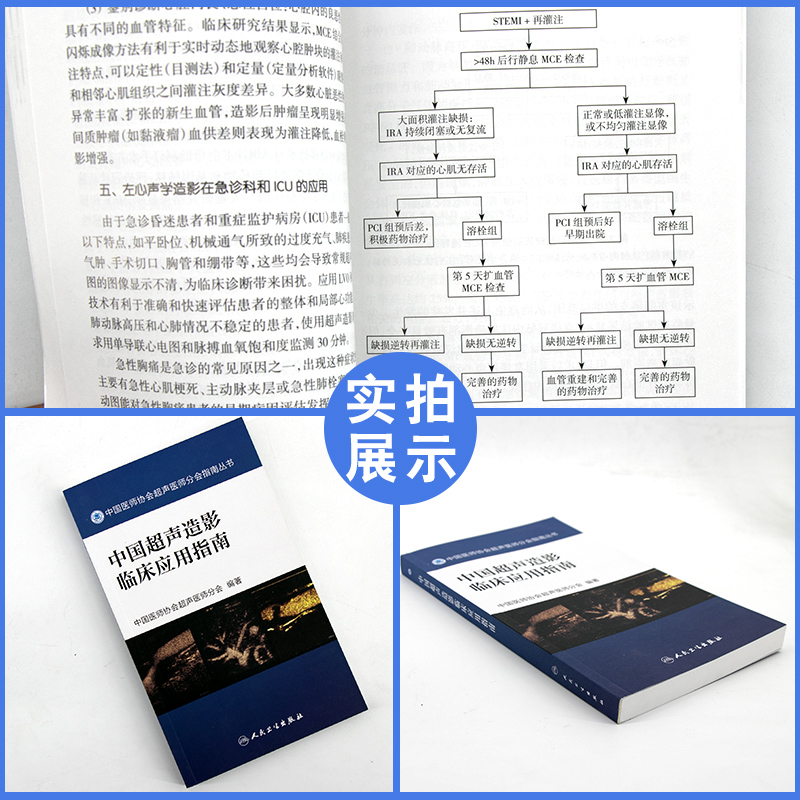 正版中国超声造影临床应用指南中国医师协会超声医师分会指南丛书人民卫生出版社超声诊断学超声医学书籍医学影像学可搭配奈特断层 - 图0