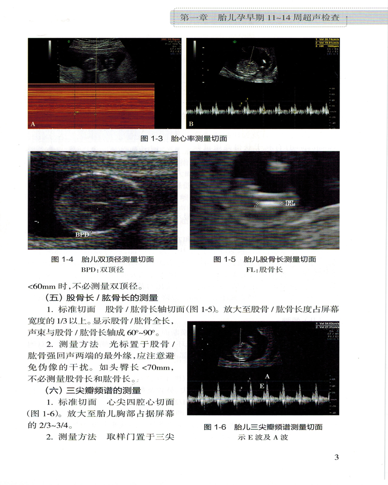 现货正版 中国胎儿产前超声检查规范 姜玉新 主编 中华医学会超声医学分会 组织编著 西医 9787117225601 人民卫生出版社 - 图2