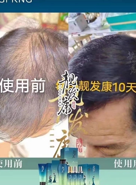 靓发康黑灵芝养发乳l升级为发界奇精华膏100g 品质保障门店直发