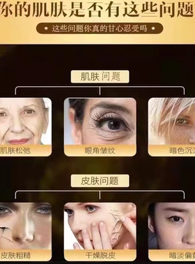 炕皱炕初老淡纹0色素0防腐剂
