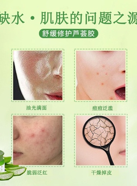 燕兰熹香港库拉索保湿晒后芦荟胶