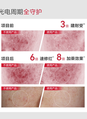 屈臣氏薇诺娜屏障修护精华液第二代1.5ml×5支 经典版 官方正品