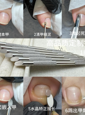 甲沟水晶矫正剔甲器嵌甲修脚工具