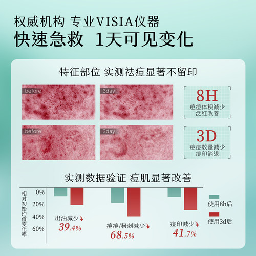 初夏堂小绿灯祛痘精华液面部闭口粉刺舒缓修护淡化青春痘印疤男女 - 图2