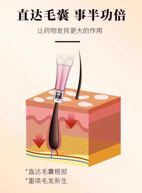 电动微晶导入仪微晶笔纹发仪
