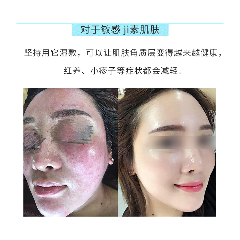 水爽膚水富氫水 8 德瑪貝爾大 DERMABELL 韓國 1000ml 巨無霸 正品授權 水爽膚水富氫水 8 德瑪貝爾大 DERMABELL 韓國 1000ml 巨無霸 正品授權
