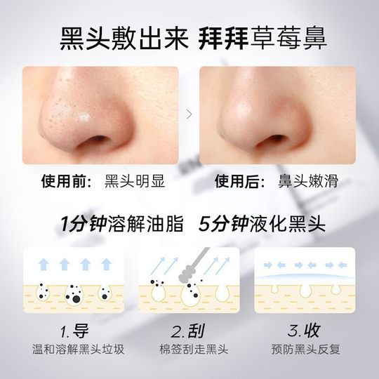 Blackhead Exporting Liquid-Refundable