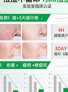 积雪草苷膏淡化痘印霜舒缓