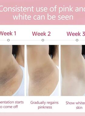 Whitening Cream For Dark Skin Armpit Thigh Inner Joint Light