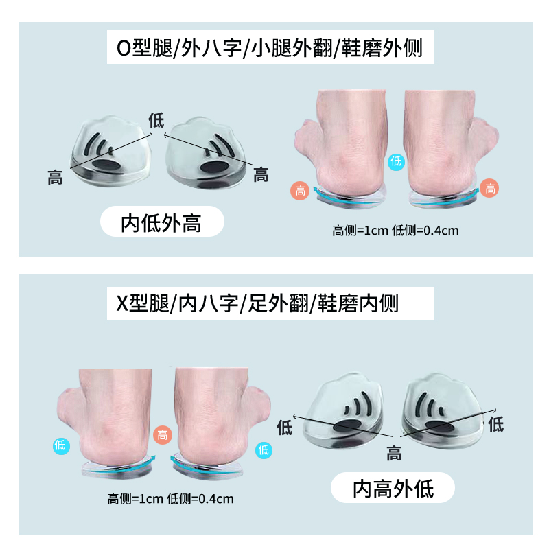 日本骨科成人专用小腿足外翻矫正鞋垫xo型腿纠正神器火山磁石脚垫 - 图0