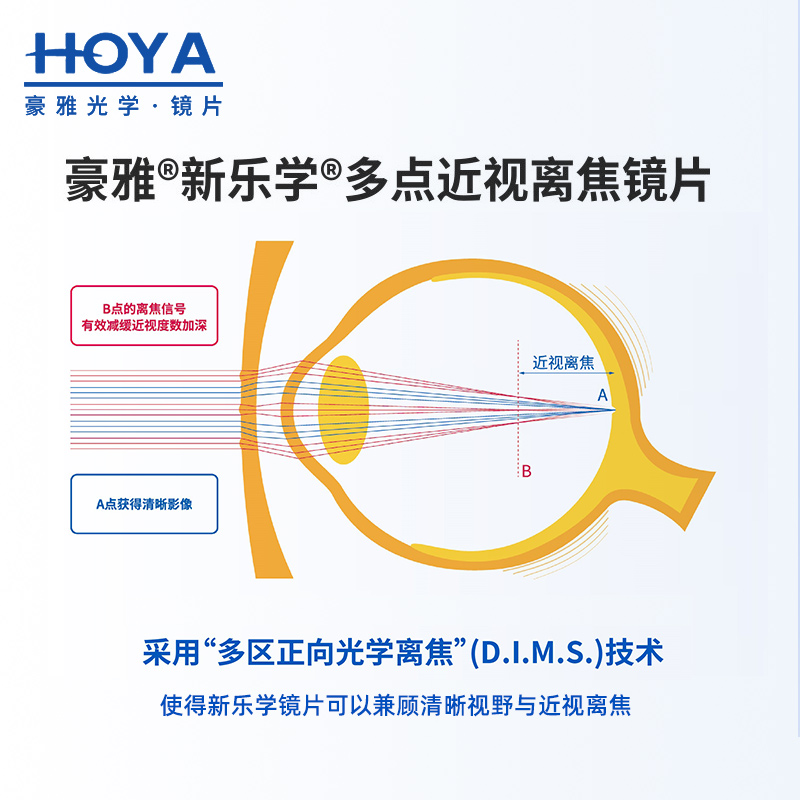 儿童青少年近视防控镜片学生延缓度数增长离焦镜片1.59 - 图2