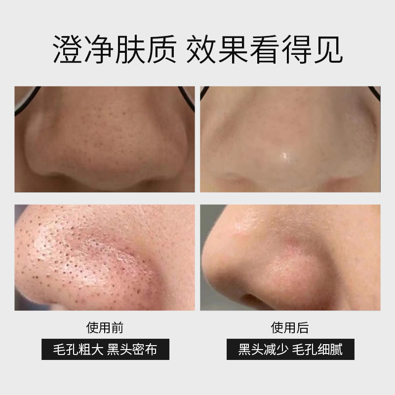 geoskincare纽西之谜黑泥清透洁净毛孔滋润细腻肌肤涂抹式泥膜 - 图2