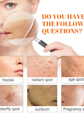Papaya Whitening Freckle Cream Lightening Facial Freckles Da