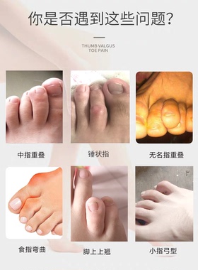 上翘脚趾固定食指中指小指