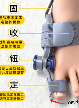 旋钮可调拇外翻矫正器