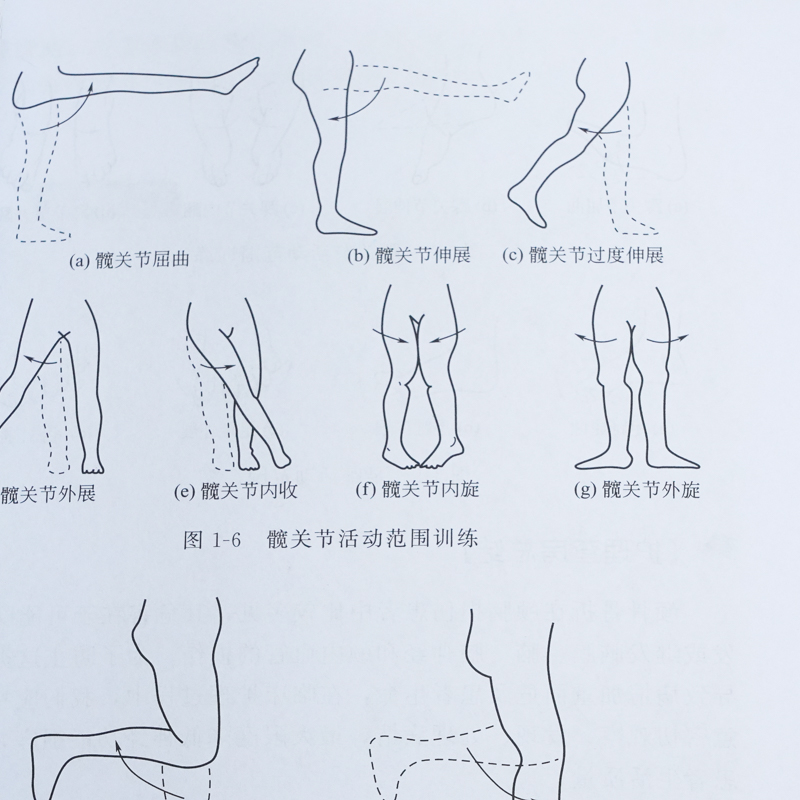 神经外科护理查房 徐德保 唐云红主编 颅脑损伤颅内肿瘤脑血管疾病神经外科疾病诊断治疗书籍 典型个案护理原理护理措施和技能操作 - 图3