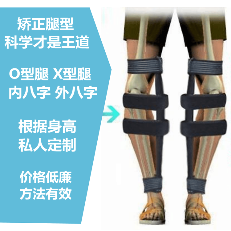 成人兒童寶寶腿型矯正帶O型腿X型矯正支架腿部羅圈腿百倍特矯正器