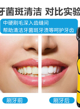 竹炭软毛牙刷成人情侣独立包装牙刷酒店家用牙刷去牙渍