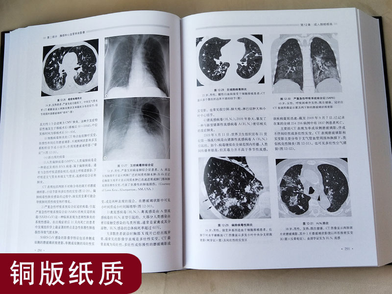 正版格艾放射诊断学第6六版上中下3册卷张敏鸣原人军医升级版胸腹部心血管骨骼肌肉神经肿瘤儿科介入临床实用医学影像学书籍格一艾 - 图2