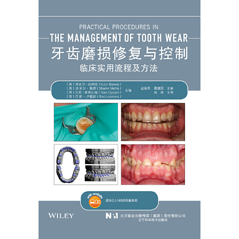 2023新书 牙齿磨损修复与控制临床实用流程及方法 苏比尔 班纳吉 周炜 患者评估诊断磨损牙列缺损治疗诊疗计划维护美学临床书籍