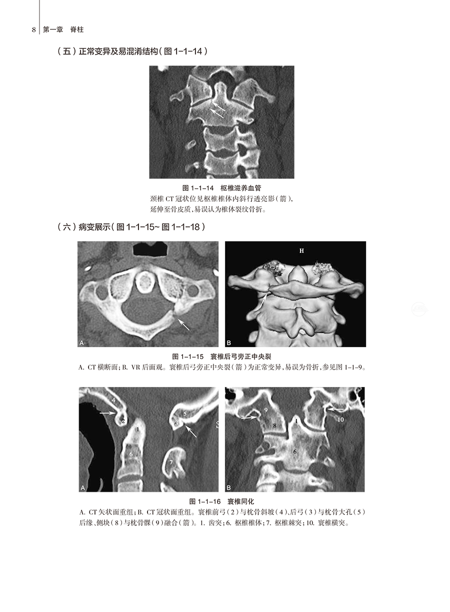 脊柱四肢影像图解 正常解剖·常见变异·常见病变胡春洪龚沈初主编影像图解放射医学解剖学临床医学影像实用书籍人民卫生出版社 - 图2