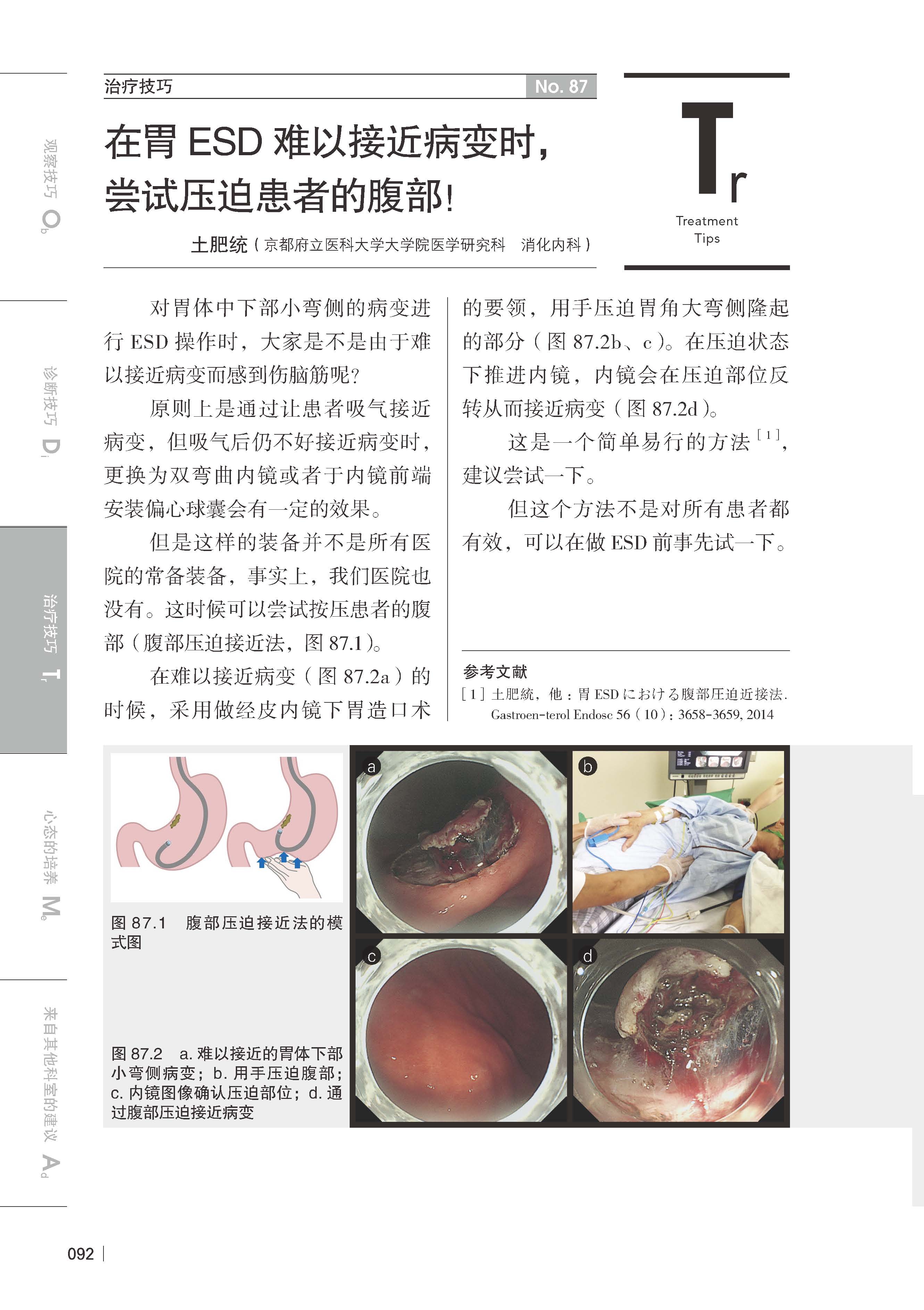 消化内镜应用提升技巧消化系统常见病内镜诊断治疗图谱常规手册指南书籍消化内镜学解剖与诊断临床实用医学书籍9787571415822-图3