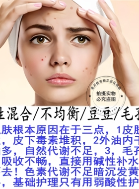 瑾泉清新乳液清爽闭口控油收毛孔