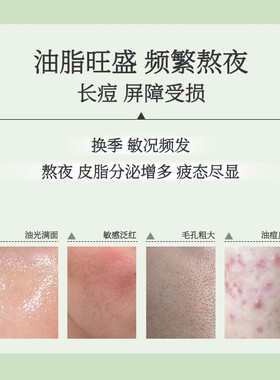 雪完美洗面奶氨基酸洁面泡沫慕斯控油祛痘收缩毛孔补水保湿清洁