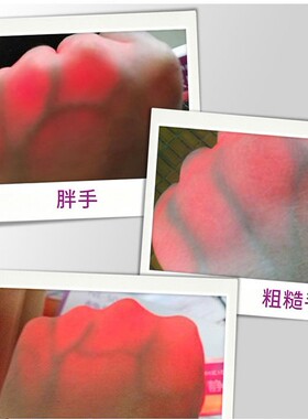 美得静脉手背血管穿刺显示仪查找仪老人挂水输液儿童红外显像仪