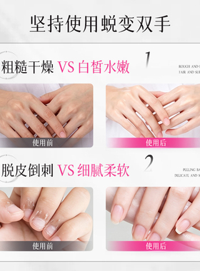 DNA钠玻色因精华手部护理组合4步分层手膜补水保湿手霜改善干燥