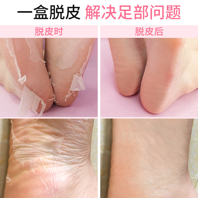 shvyog舒友阁旗舰店舒友阁足膜去死皮老茧嫩脚部后跟干裂美足去角质脱皮嫩白保湿脚膜1